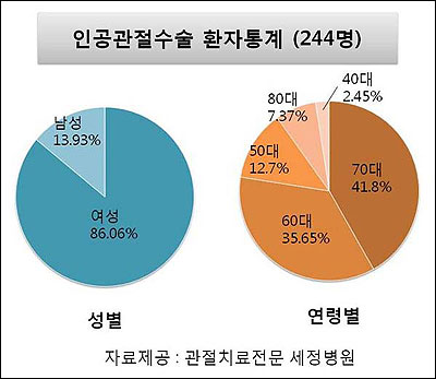 여성 관절 질환 - 인공관절수술 통계