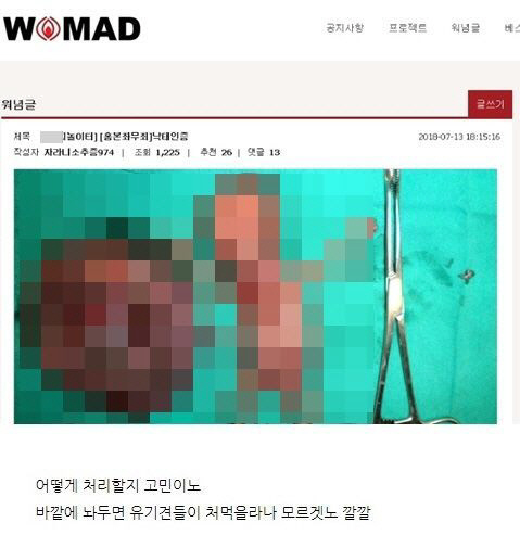 워마드 ‘태아 조롱’ 게시물 논란…난도질 사진 올려