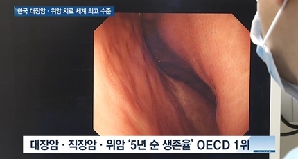 [쿠키건강뉴스] 한국 대장암·위암 치료 ‘세계 최고’…만성질환 관리는 미흡