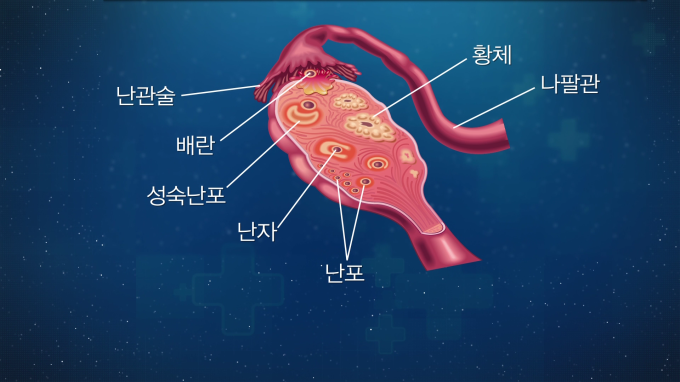 [글로벌 명의 명클리닉] 난소암 등 부인암 전문가 이근호 서울성모병원 산부인과 교수