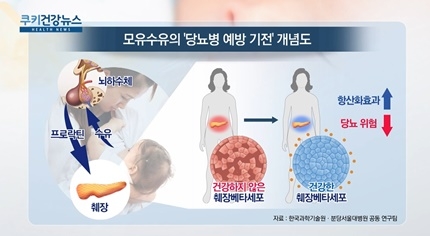 [쿠키건강뉴스] “모유 수유, 출산 후 산모 당뇨 발병 위험 낮춰”