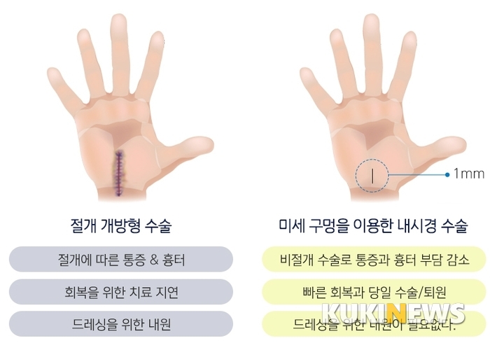 [건우리포트] 손목터널증후군에 대한 오해와 진실