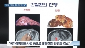[쿠키건강뉴스] “국내 간경화 발병 주원인 B형간염에서 술로 변화”