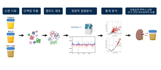 소변검사로 '루푸스 신염 ' 조기 진단한다