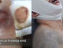 [쿠키영상] ‘부산행 실사판?’ 유리창 깨고 목덜미 물어! ‘좀비 마약 탓?’…“조현병 환자로 보여”