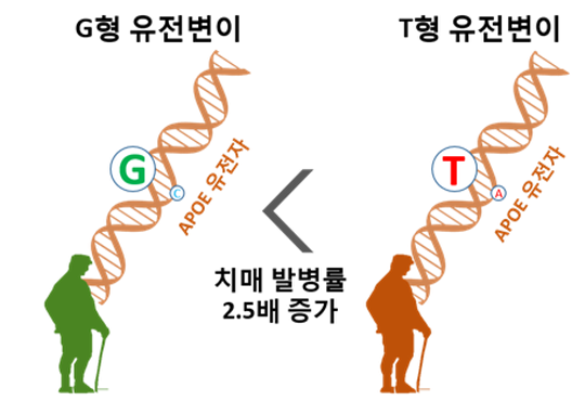 구강세포로 치매 위험도 측정한다