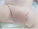 내 아이의 사타구니가 불룩…'소아 서혜부 탈장'일까?