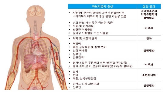 개별 증상만으로는 진단 어려운 '파브리병'