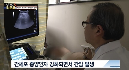 [쿠키건강뉴스-체크리포트] 간염 방치하면 간경화·간암까지…“백신·치료제로 효과적 대응·관리 가능”