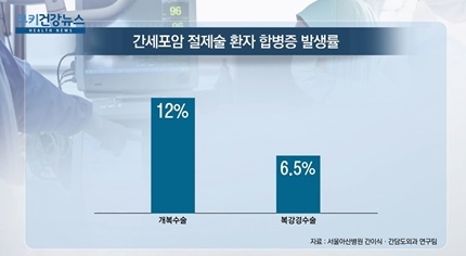 [쿠키건강뉴스] “간 절제 시 복강경수술이 개복수술보다 부작용 적어”