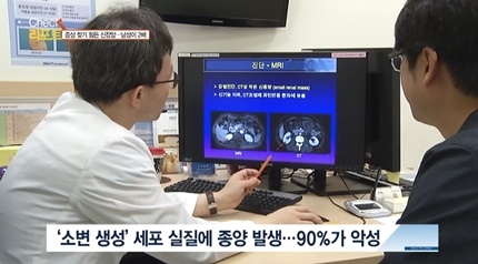 [쿠키건강뉴스-체크리포트] 악성도 높지만 증상 찾기 힘든 신장암, 콩팥조직 살리는 게 관건…“기능 쇠락할수록 투석치료 가능성↑”