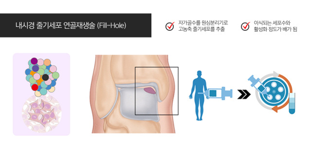 [건우리포트] 