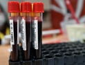‘피’ 부족 연속…헌혈 기념품이 도움 될까?