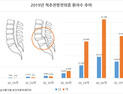 [척리포트] 척추질환 전방전위증 극복, 조기발견 치료에 달렸다 