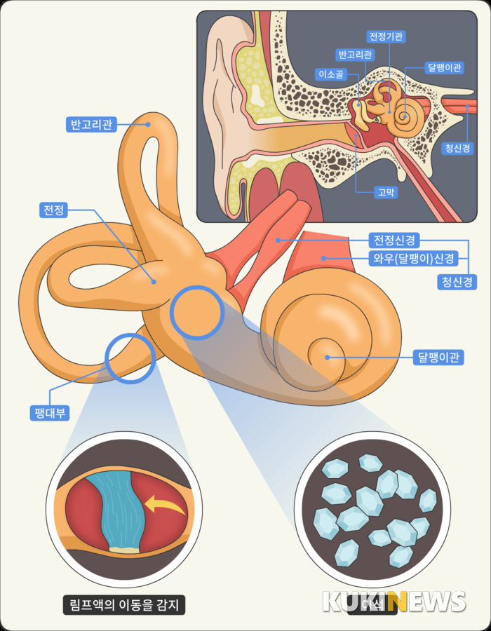 [하나ENT리포트] 어지럼증의 가장 흔한 원인, 이석증의 치료