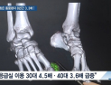 [쿠키건강뉴스] 통풍으로 응급실 찾은 환자 8년간 3.3배 증가