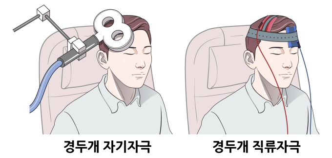 신경과·정신과 치료법 접목한 난치성 이명 치료법 개발