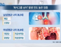 [쿠키건강뉴스] “고기 즐기는 남성 ‘폐암’·여성 ‘대장암’ 빈도 높아”