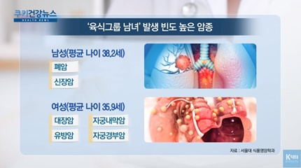 [쿠키건강뉴스] “고기 즐기는 남성 ‘폐암’·여성 ‘대장암’ 빈도 높아”