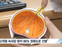 [쿠키건강뉴스] “실명 위험 높은 녹내장, 인공지능으로 조기 진단”