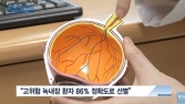 [쿠키건강뉴스] “실명 위험 높은 녹내장, 인공지능으로 조기 진단”