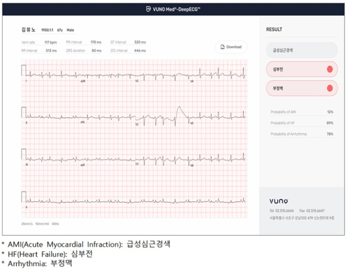 심전도로 '심부전·심근경색' 탐색…'제16호 혁신의료기기' 지정