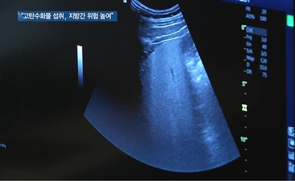 [쿠키건강뉴스] “탄수화물 많이 먹으면 비알코올성 지방간 위험 커져”