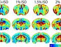 저산소증 활용한 MRI 뇌혈류 반복 촬영법 개발