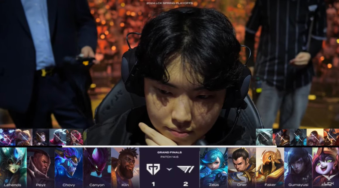 ‘쵸비’ 정지훈의 벌어지는 가르마…“이마를 열면 복이 온다” [LCK]