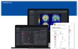 ‘주사 대신 AI’…건국대병원, 알츠하이머 진단 솔루션 BTX BRAIN 도입